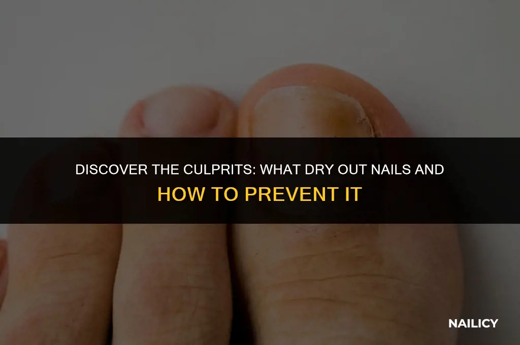 what dry out nails
