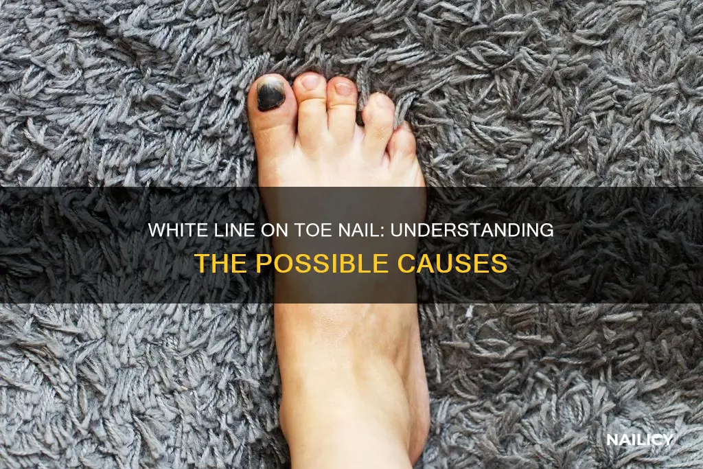 what dues a white line across toe nail mean