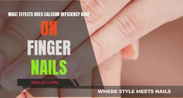 Calcium Deficiency: Weak and Brittle Fingernails