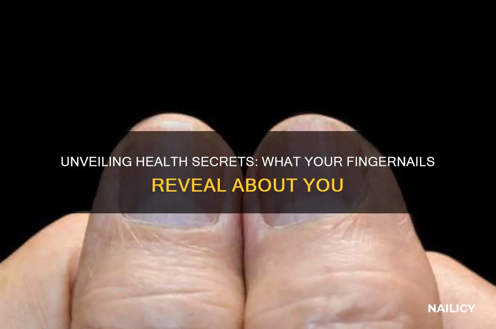 what fingernails say about health