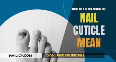 Black Around Toe Nail Cuticle: Understanding the Signs and Causes