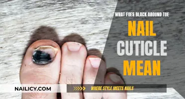 Black Around Toenail Cuticles: What Does It Mean?