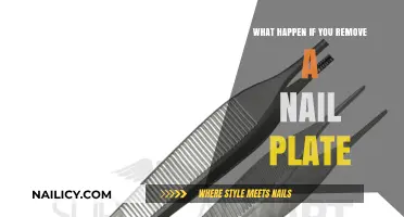 Uncovering the Risks of Removing Nail Plates
