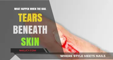 Nail Tears Beneath Skin: Causes, Symptoms, and Treatment Explained