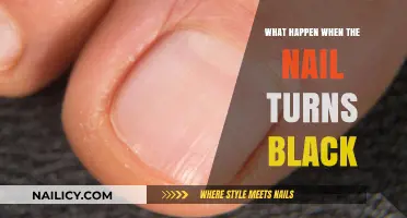 Black Toenail Causes: Understanding Discoloration, Risks, and Treatment Options