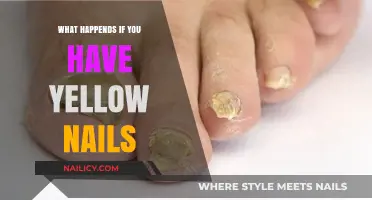 Yellow Nails: Causes, Concerns, and When to Seek Medical Advice