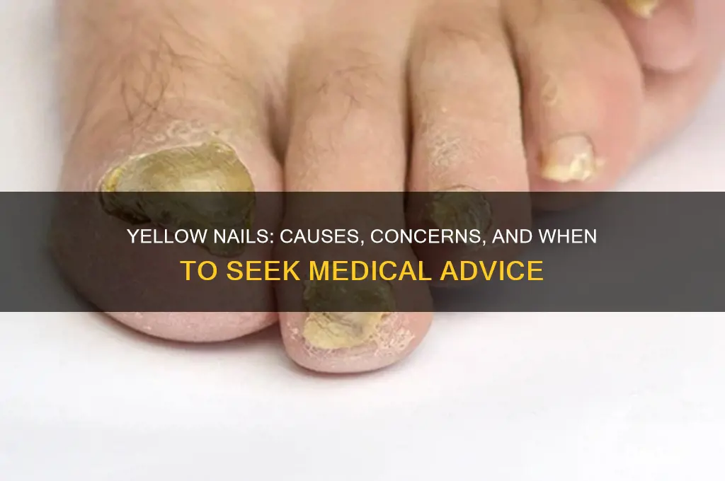 what happends if you have yellow nails