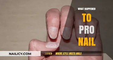 The Mysterious Decline of Pro Nail: An Industry Insider's Perspective