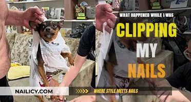Nail Clipping Gone Wrong: Unexpected Chaos Unfolds in Minutes