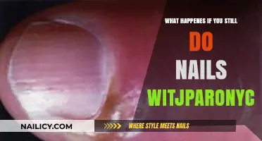 Risks of Doing Nails with Paronychia: What You Need to Know
