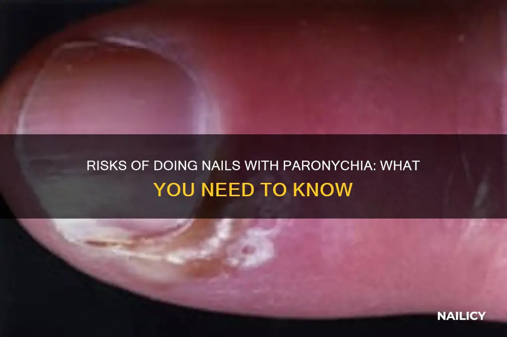 what happenes if you still do nails witjparonychia