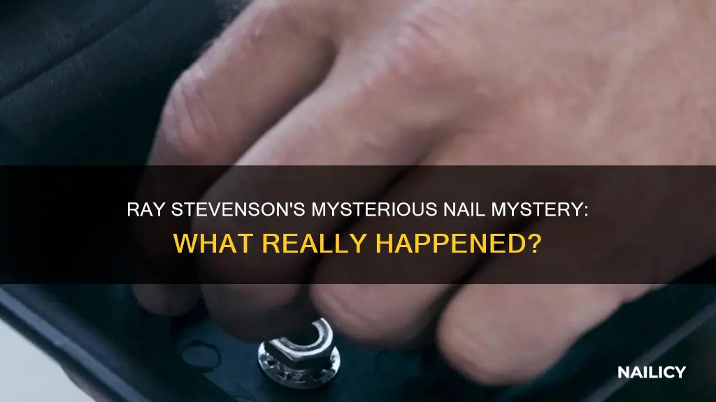 what happenes to ray stevensons finger nail