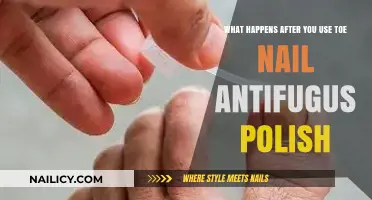 Post-Treatment Care: What to Expect After Using Toenail Antifungal Polish