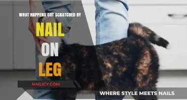 Scratches from Nails: Understanding Risks, Treatment, and Prevention on Legs