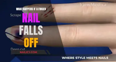 Nail Loss: What to Expect and How to Handle It