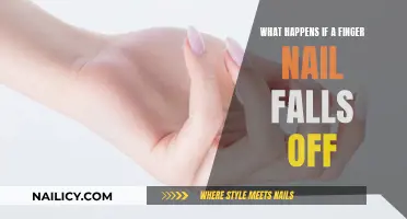 Fingernail Fell Off? Here's What You Need to Know