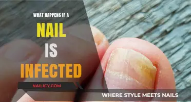 Infected Nail Symptoms, Causes, and Treatment Options Explained