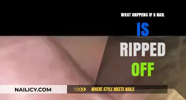 Nail Ripped Off: Pain, Healing, and Recovery Explained