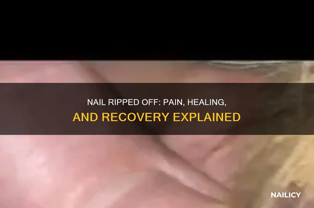 what happens if a nail is ripped off
