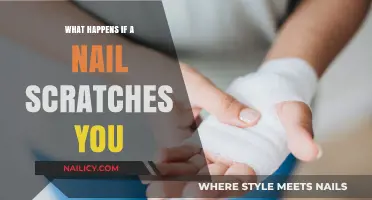 Nail Scratch Risks: What Happens When a Nail Scratches You?