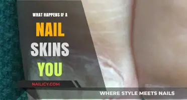 Nail Skinned? Understanding the Risks, Healing Process, and Prevention Tips