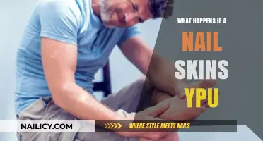 Nail Skin Puncture: Risks, Symptoms, and Immediate First Aid Steps