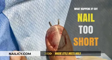 Nail Nuisance: Short Nails, Big Problems