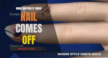 Nail Emergency: What to Do When Your Finger Nail Comes Off