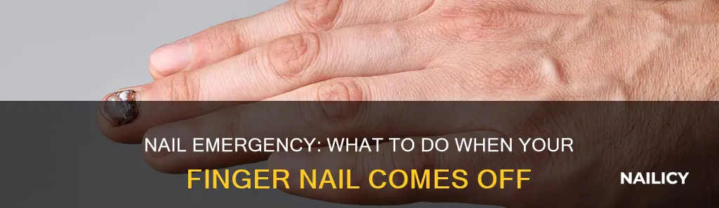 what happens if finger nail comes off