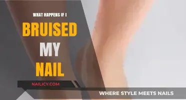 Bruised Nail? Here's What Happens and How to Heal It