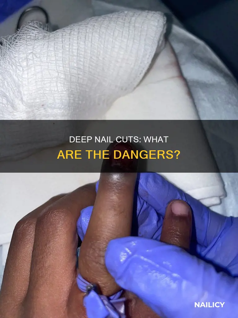 what happens if i cut my nail too deep