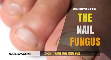 Cutting Nail Fungus: What Are the Risks?