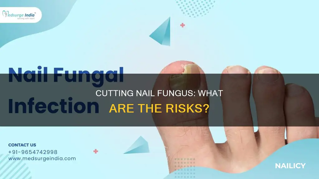 what happens if i cut the nail fungus