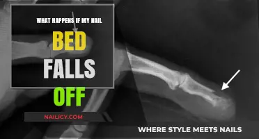 Nail Bed Falls Off: Causes, Risks, and Recovery Explained