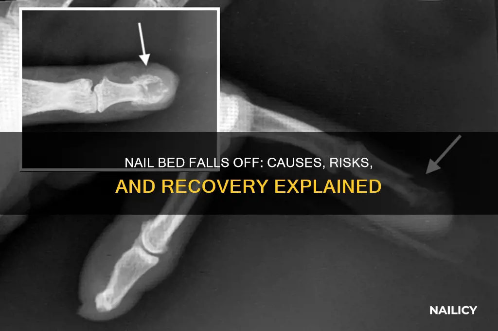 what happens if my nail bed falls off