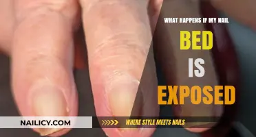 Exposed Nail Bed: Risks, Healing, and Prevention Tips Explained