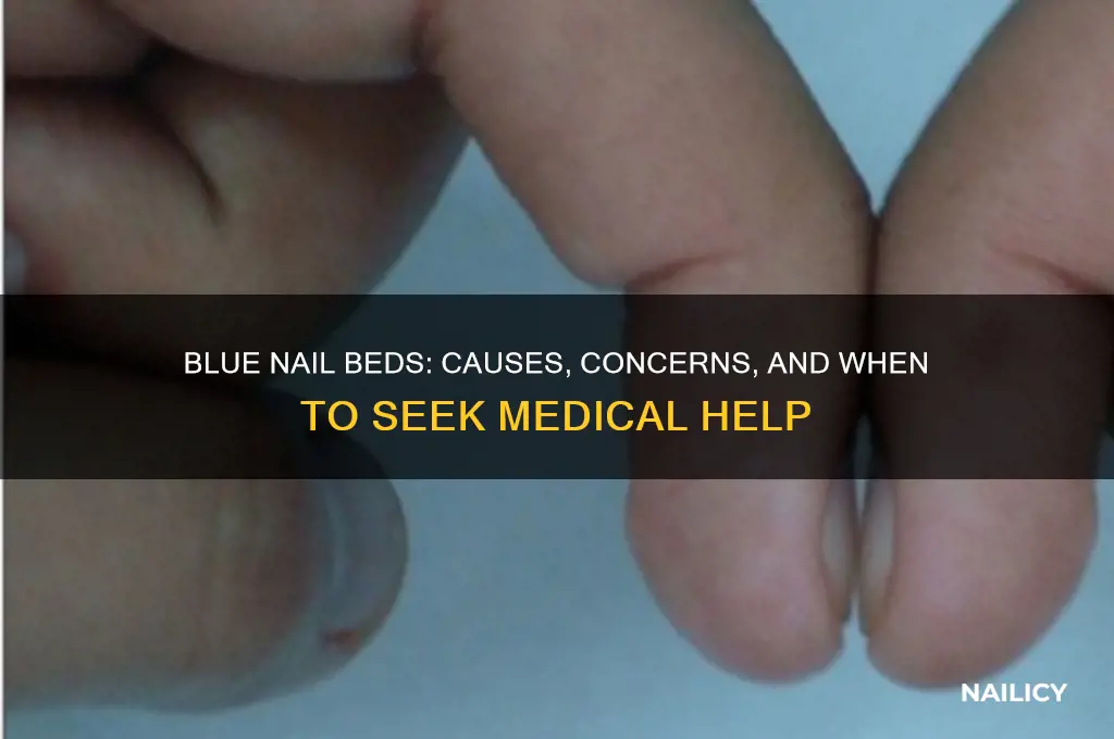 what happens if my nail beds are blue