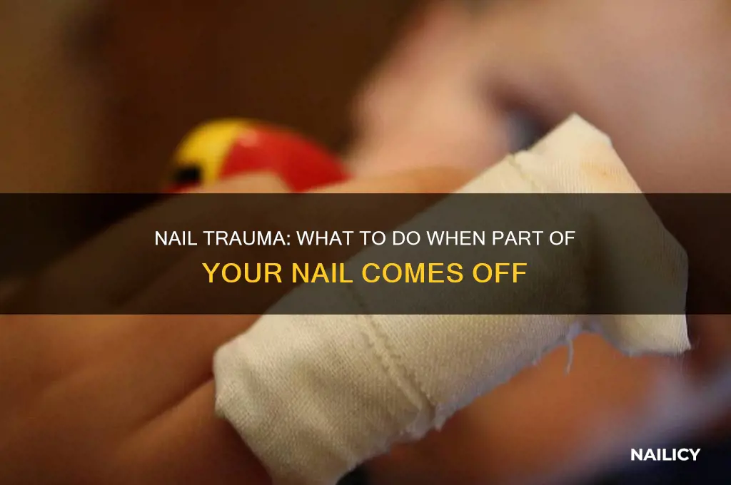 what happens if part of nail comes off