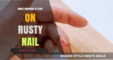 Rusty Nail Risks: What Happens If You Step on One?