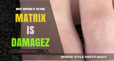 Nail Matrix Damage: Causes, Symptoms, and Effective Treatment Options