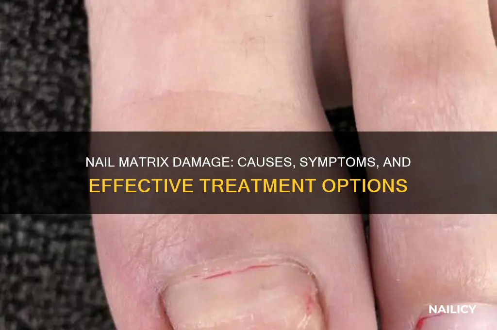 what happens if tge nail matrix is damagez