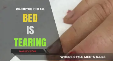 Nail Bed Tearing: Causes, Symptoms, and Effective Treatment Options
