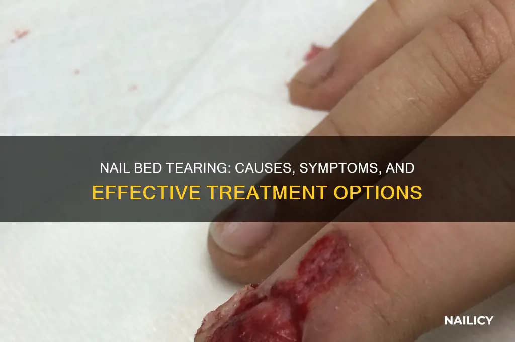 what happens if the nail bed is tearing