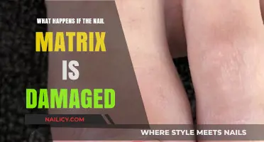 Nail Matrix Damage: Causes, Symptoms, and Recovery Explained