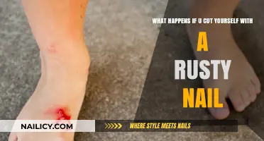 Rusty Nail Wounds: What You Need to Know