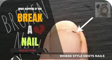 Broken Nail Emergency: What Happens and How to Fix It Fast