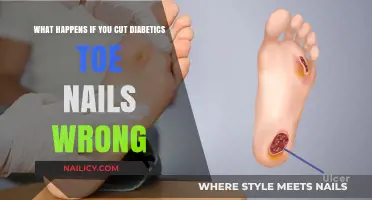 Toe-nail Trimming: Diabetics Need to Take Extra Care