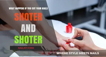 The Danger of Cutting Nails Too Short