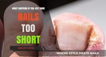 Nail Woes: Short Nails, Big Problems