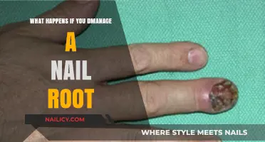 Managing a Nail Root: Risks, Complications, and Proper Care Tips